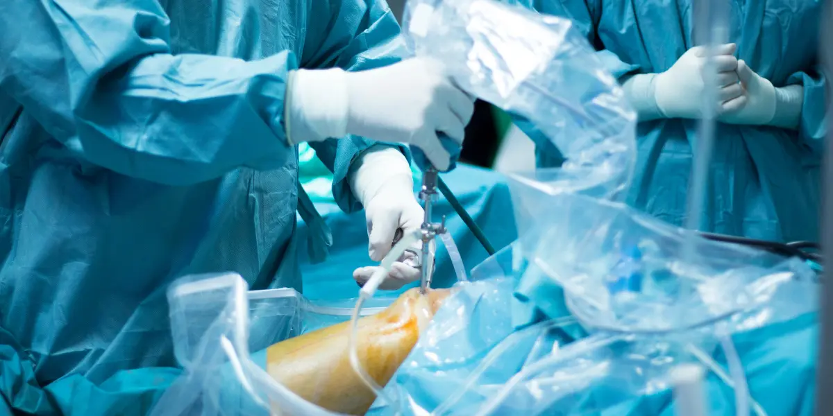 Saiba Como é Feita a Cirurgia de Prótese de Joelho