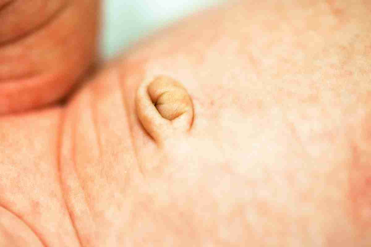 Quanto tempo leva para o umbigo do bebê entrar para dentro?