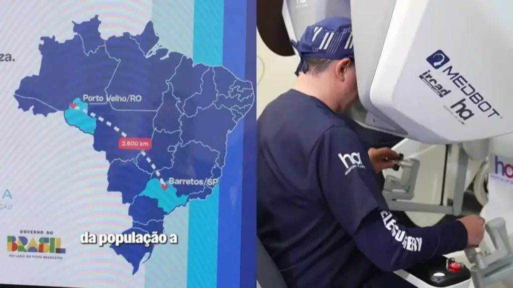 SUS faz 1ª telecirurgia robótica a 2.700 km em hospital filantrópico 1 SUS faz 1ª telecirurgia robótica a 2.700 km em hospital filantrópico
