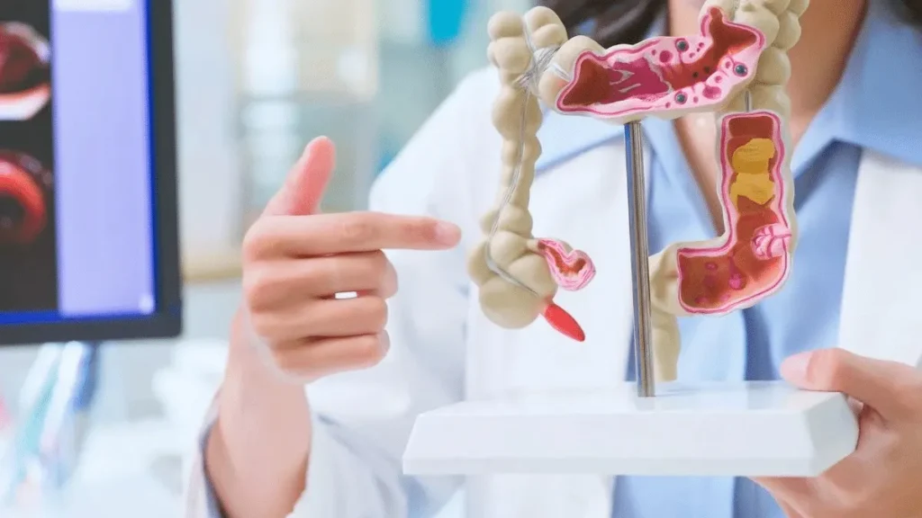 Intestino saudável em 30 dias? Médica revela hábitos 1 Intestino saudável em 30 dias? Médica revela hábitos