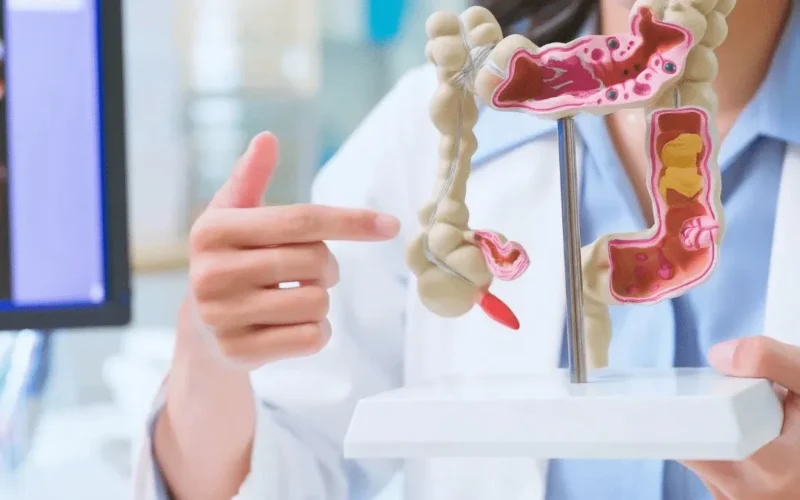 Intestino saudável em 30 dias? Médica revela hábitos