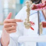 Intestino saudável em 30 dias? Médica revela hábitos