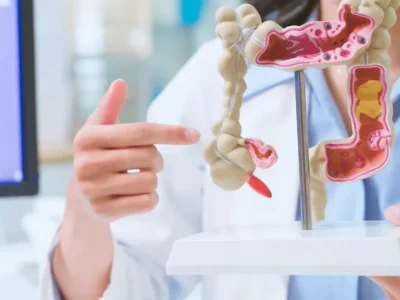 Intestino saudável em 30 dias? Médica revela hábitos