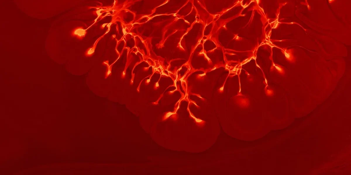 Visão embaçada pode ser sinal de aneurisma cerebral