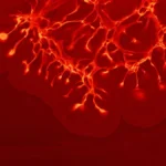 Visão embaçada pode ser sinal de aneurisma cerebral